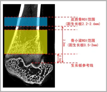 双材料仿体成像